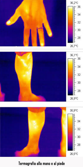 termografia nel settore Medico