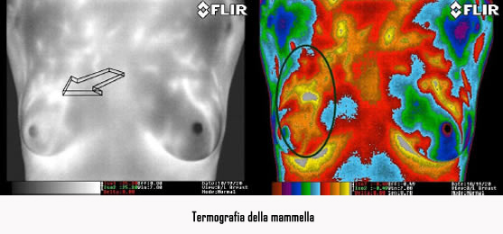 termografia nel settore Medico