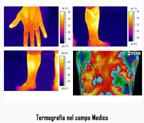 termografia nel campo medico